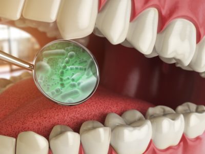 Illustration of bad breath causing bacteria on teeth